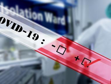 Здравната каса ще плаща лечението и тестването за Covid-19