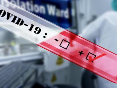 Новите случаи с Covid-19 за последното денонощие в България преминаха 800