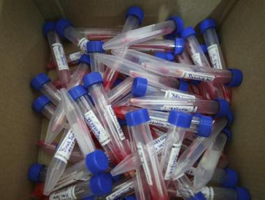 Отново над 3900 нови случая и над 100 починали с COVID-19 в България