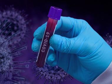 Нови 1123 случая на COVID-19 при 2787 теста