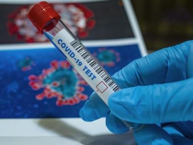 Германия създаде PCR тест, откриващ новите COVID щамове