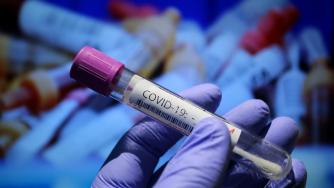 Турция удължи изискването за PCR тест за българи