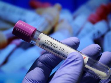 Турция удължи изискването за PCR тест за българи