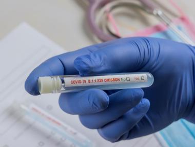 Учен от Оксфорд: Омикрон не е същата болест като преди година