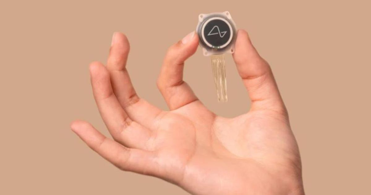 Първият пациент, на когото е имплантиран мозъчен чип от Neuralink,