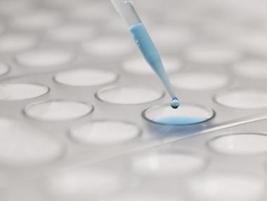 Лекарство срещу алцхаймер отива на последни тестове