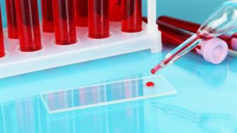 Oткриват рак от 1 капка кръв