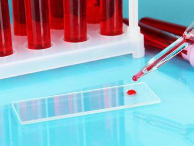 Oткриват рак от 1 капка кръв