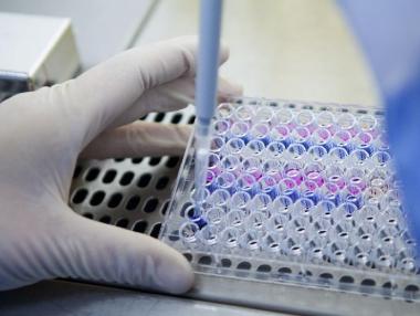 Благотворителните организаци във Великобритания губят 230 млн. евро от Brexit