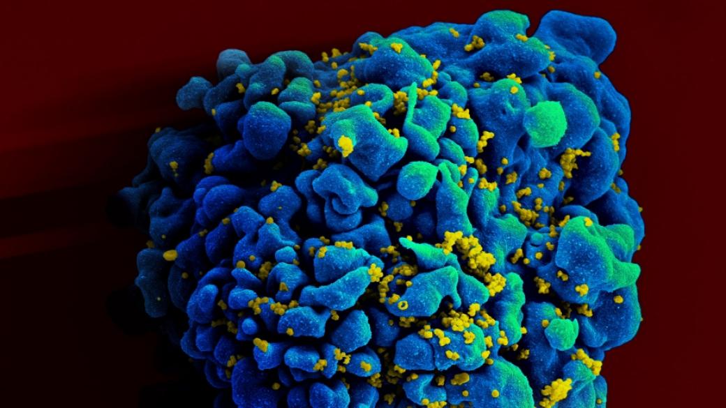 Учени с първи успех срещу ХИВ при големи животни