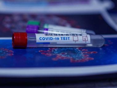 Лек спад при новозаразените с Covid-19 в България